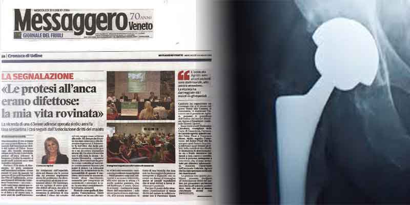 PROTESI ALL’ANCA DIFETTOSE: I RISARCIMENTI PER I DANNI ALLA SALUTE